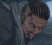 An angry man with blood on his face